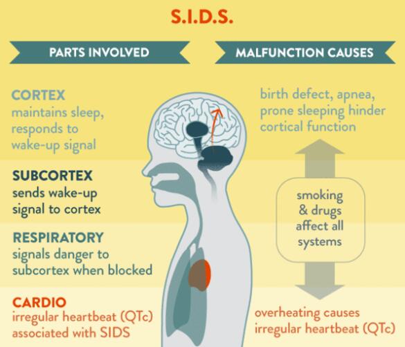 What Is SIDS And What Should I Do? Baby Love Swings