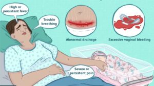 cesarean section recovery